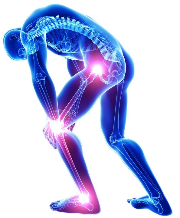Острая боль при движении - симптом заболевания суставов. 