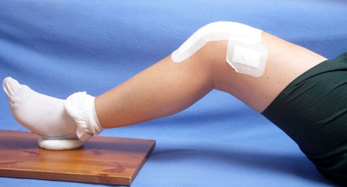 травма колена как причина артроза